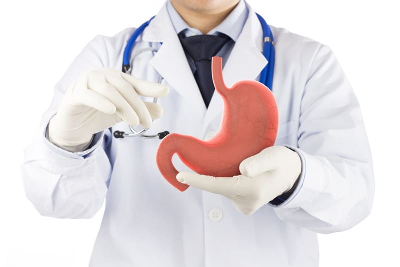 Cirugía anti reflujo por laparoscopia